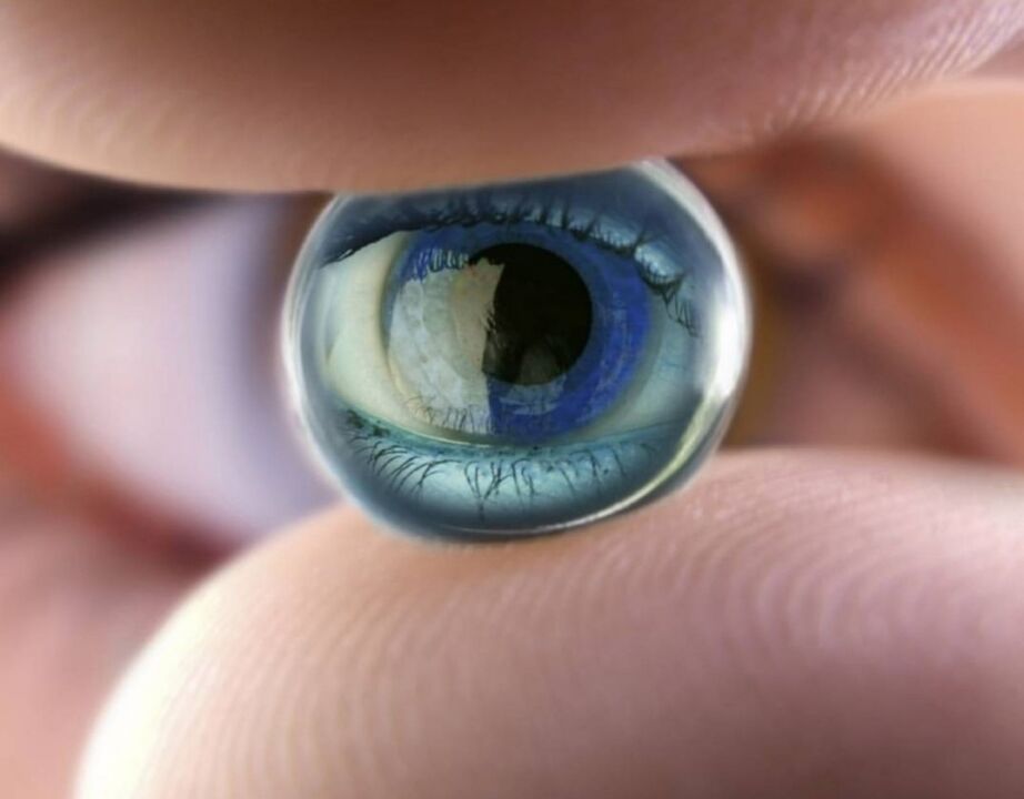 Az éjszakai ortokeratológiai lencsék megállítják a látáskárosodás előrehaladását